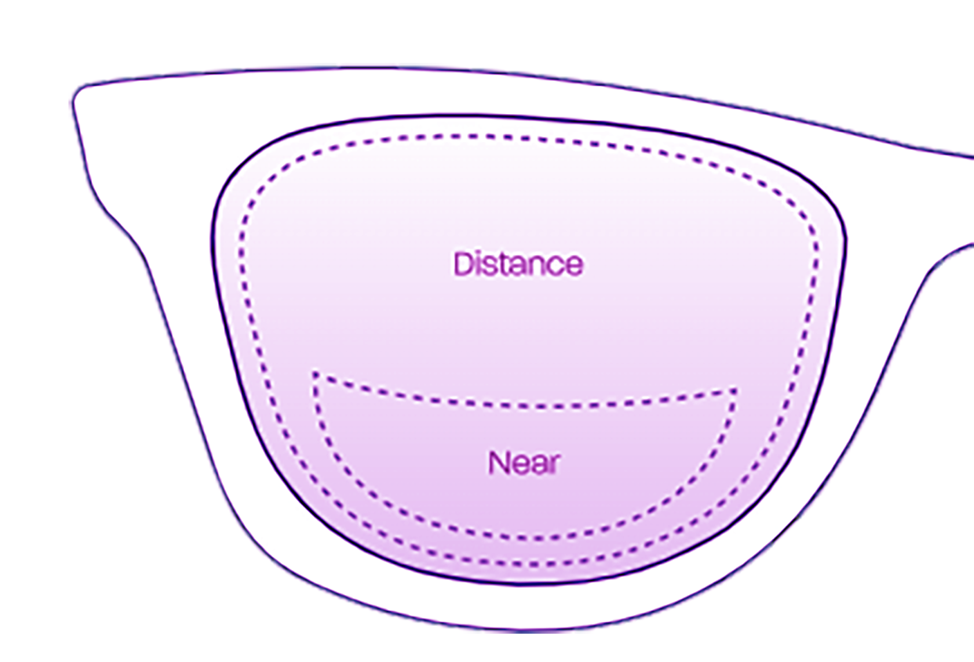 Bifocal